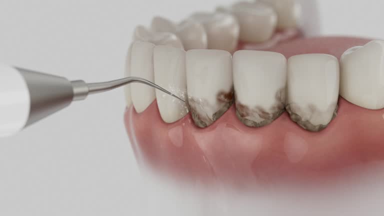 Reliable Dental Implants contractor in Gorman, TX by Smile Center Dentistry